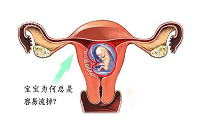 习惯性流产