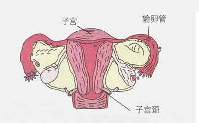 子宫性不孕